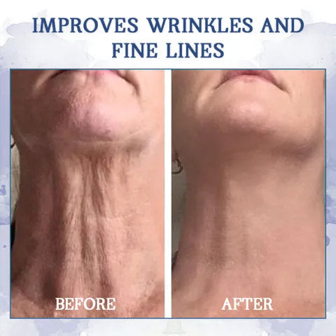 ✨𝐋𝐚𝐬𝐭 𝐃𝐚𝐲 𝐃𝐢𝐬𝐜𝐨𝐮𝐧𝐭: 87% 𝐎𝐅𝐅🌸𝐀𝐝𝐯𝐚𝐧𝐜𝐞𝐝 𝐅𝐢𝐫𝐦𝐢𝐧𝐠 & 𝐖𝐫𝐢𝐧𝐤𝐥𝐞-𝐑𝐞𝐝𝐮𝐜𝐢𝐧𝐠 𝐂𝐫𝐞𝐚𝐦: Restore Skin Elasticity⭐-PLAWLTD