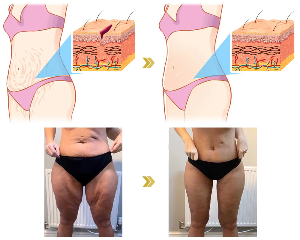 ✨𝐋𝐚𝐬𝐭 𝐃𝐚𝐲 𝐃𝐢𝐬𝐜𝐨𝐮𝐧𝐭: 87% 𝐎𝐅𝐅🌸𝐀𝐝𝐯𝐚𝐧𝐜𝐞𝐝 𝐅𝐢𝐫𝐦𝐢𝐧𝐠 & 𝐖𝐫𝐢𝐧𝐤𝐥𝐞-𝐑𝐞𝐝𝐮𝐜𝐢𝐧𝐠 𝐂𝐫𝐞𝐚𝐦: Restore Skin Elasticity⭐-PLAWLTD