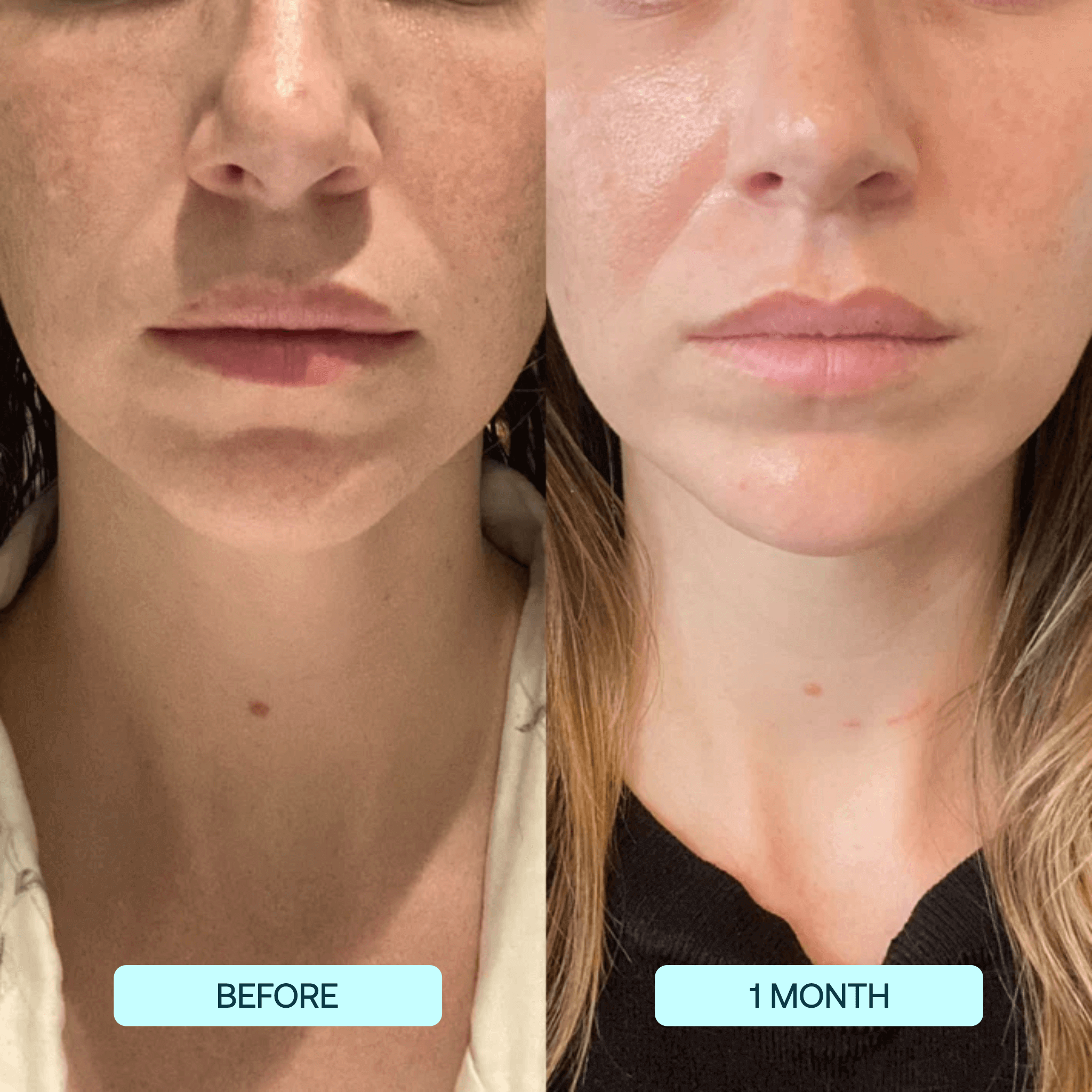 🌸Collagen Mask +VC spray🌸-PLAWLTD