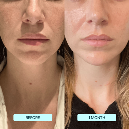 🌸Collagen Mask +VC spray🌸-PLAWLTD