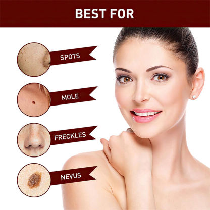 ✨Tags & Moles Remover-PLAWLTD