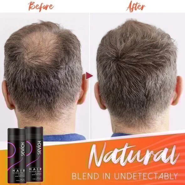 🔥BUY 2 GET 1 FREE - Fluffup Secret Hair Fiber Powder