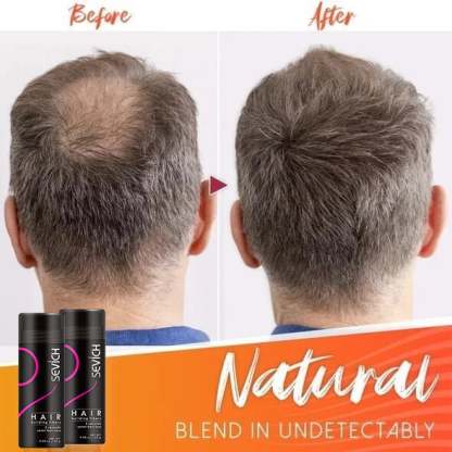 🔥BUY 2 GET 1 FREE - Fluffup Secret Hair Fiber Powder