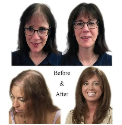 Natural Human Hair Clip 150% Density | Solve the problem of hair loss!