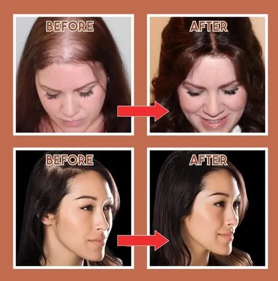 Natural Human Hair Clip 150% Density | Solve the problem of hair loss!