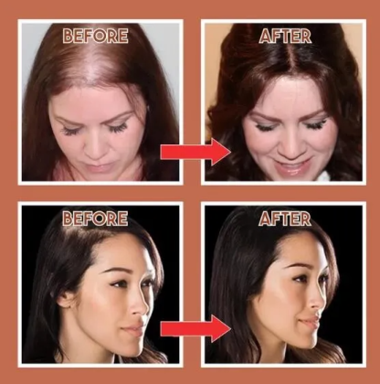 Natural Human Hair Clip 150% Density | Solve the problem of hair loss!