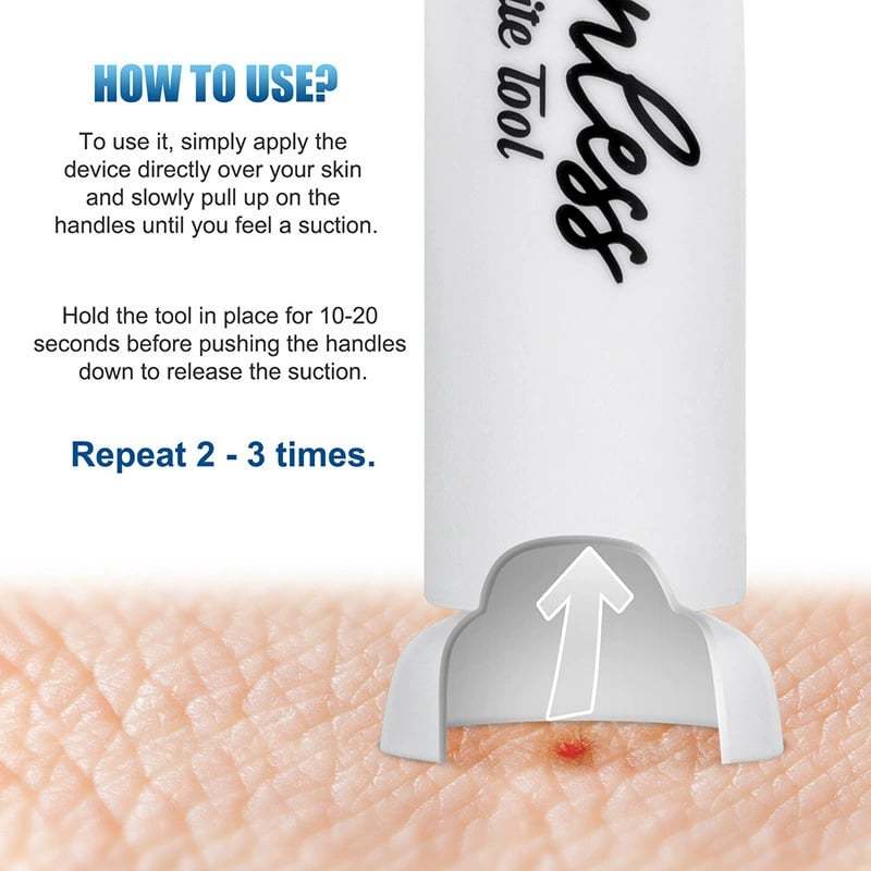 🦟 Experience Instant Relief  ✨ Ultimate Bite & Sting Relief Tool - For Itch-Free, Comfortable Days!-tidenox