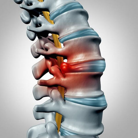 back brace for lower back pain