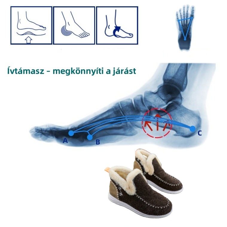(🔥Ma 50% kedvezménnyel - ne hagyd ki ezt a lehetőséget) ⏰ - Puha és kényelmes, gyapjú női pamut cipő (ívtámasz - megkönnyíti a járást)