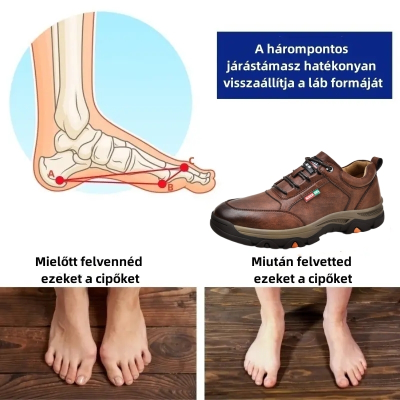 【🎁50% kedvezmény ma - ne hagyd ki】 Ergonomikus kialakítású ortopéd cipő - kiváló minőségű bőr + kézzel varrott 👞