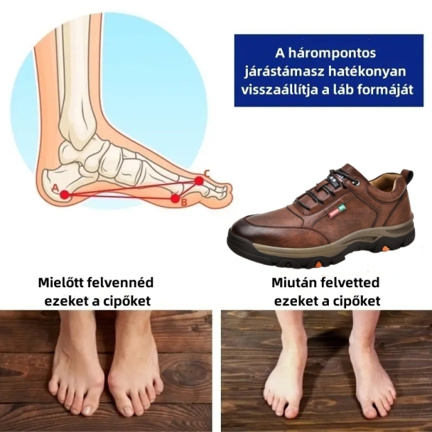 【🎁50% kedvezmény ma - ne hagyd ki】 Ergonomikus kialakítású ortopéd cipő - kiváló minőségű bőr + kézzel varrott 👞
