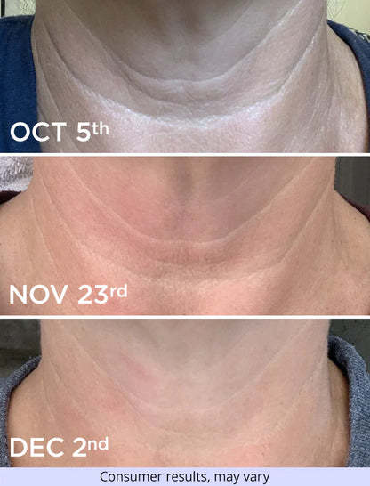 🔥Last Day 75% OFF-🤩Glow Neck Cream