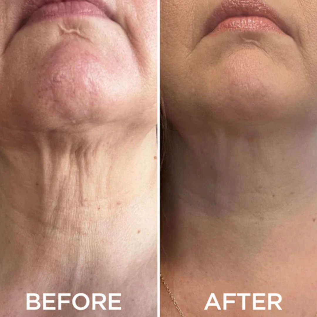 🔥Last Day 75% OFF-🤩Glow Neck Cream