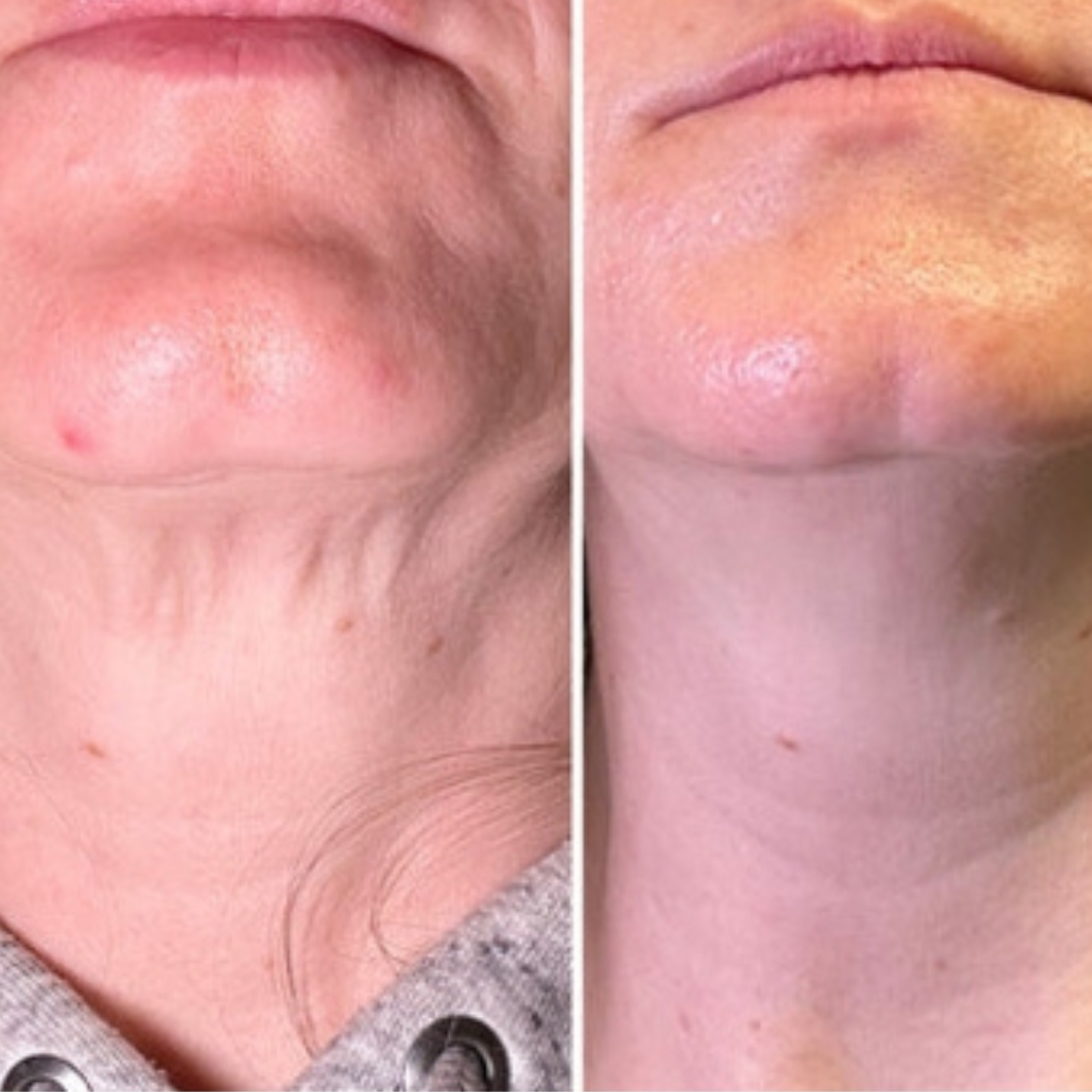 🔥Last Day 75% OFF-🤩Glow Neck Cream