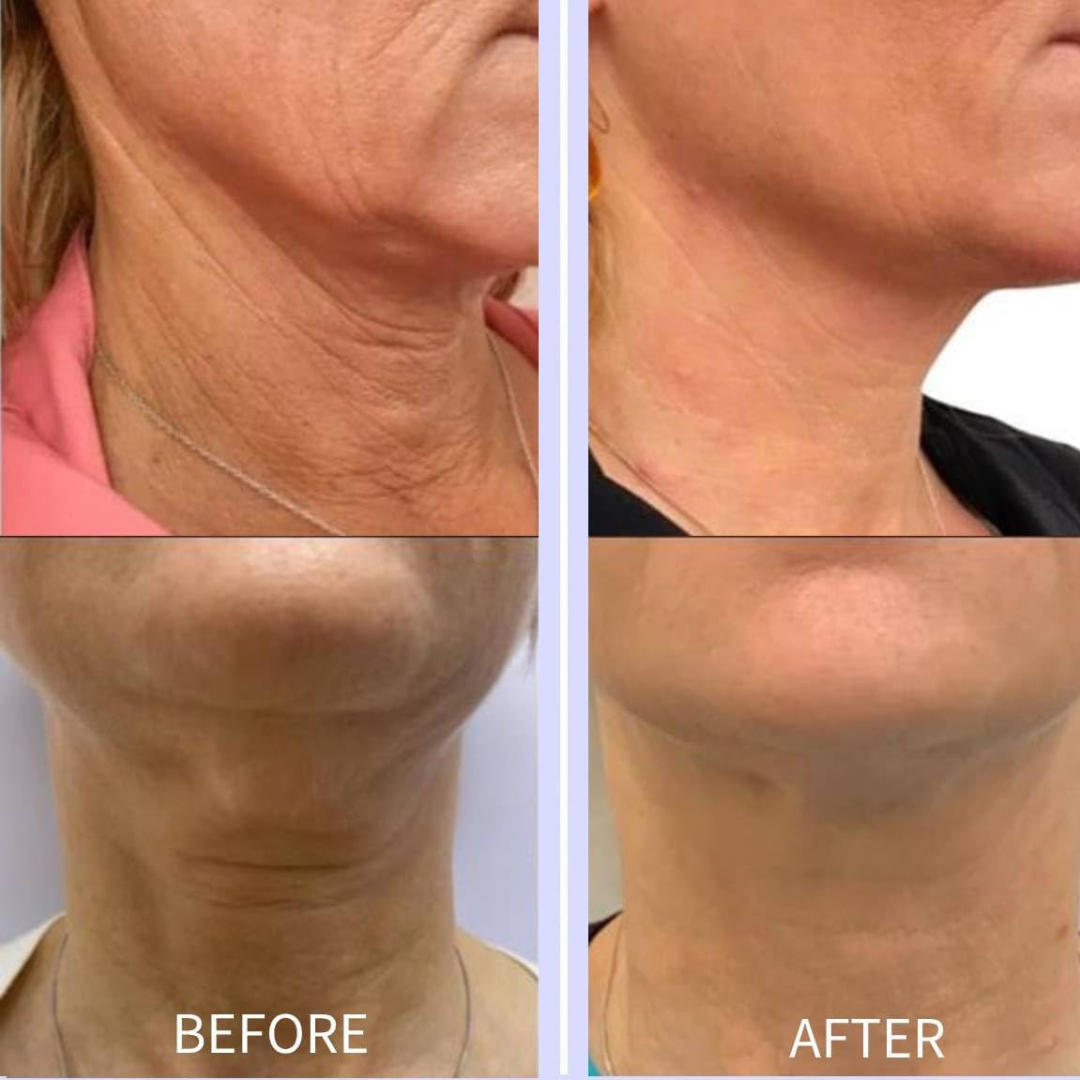 🔥Last Day 75% OFF-🤩Glow Neck Cream