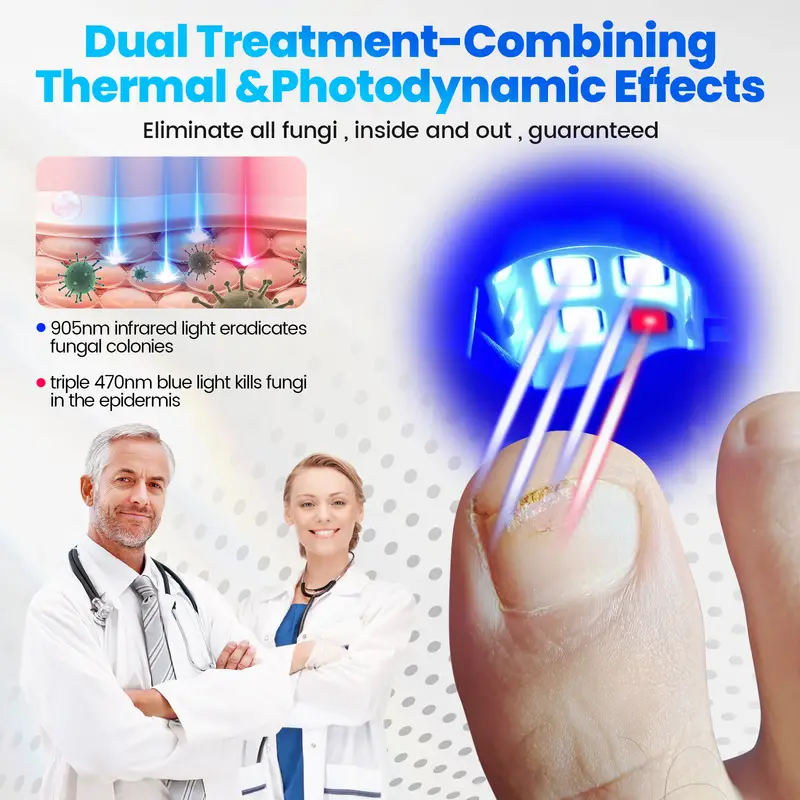 Urządzenie laserowe do czyszczenia grzyba paznokci, laser przeciwgrzybiczy Laserowe leczenie grzybicy paznokci na uszkodzone, przebarwione grube paznokcie u rąk i nóg, terapia paznokci na grzybicę paznokci, wygodna do użytku domowego