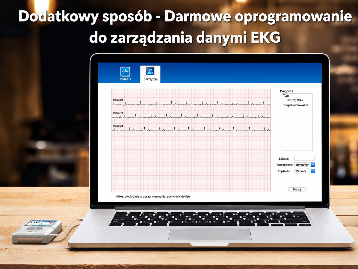 EMAY przenośny monitor EKG (kompatybilny z iPhone, Android, Mac i Windows) | Osobisty monitor serca EKG