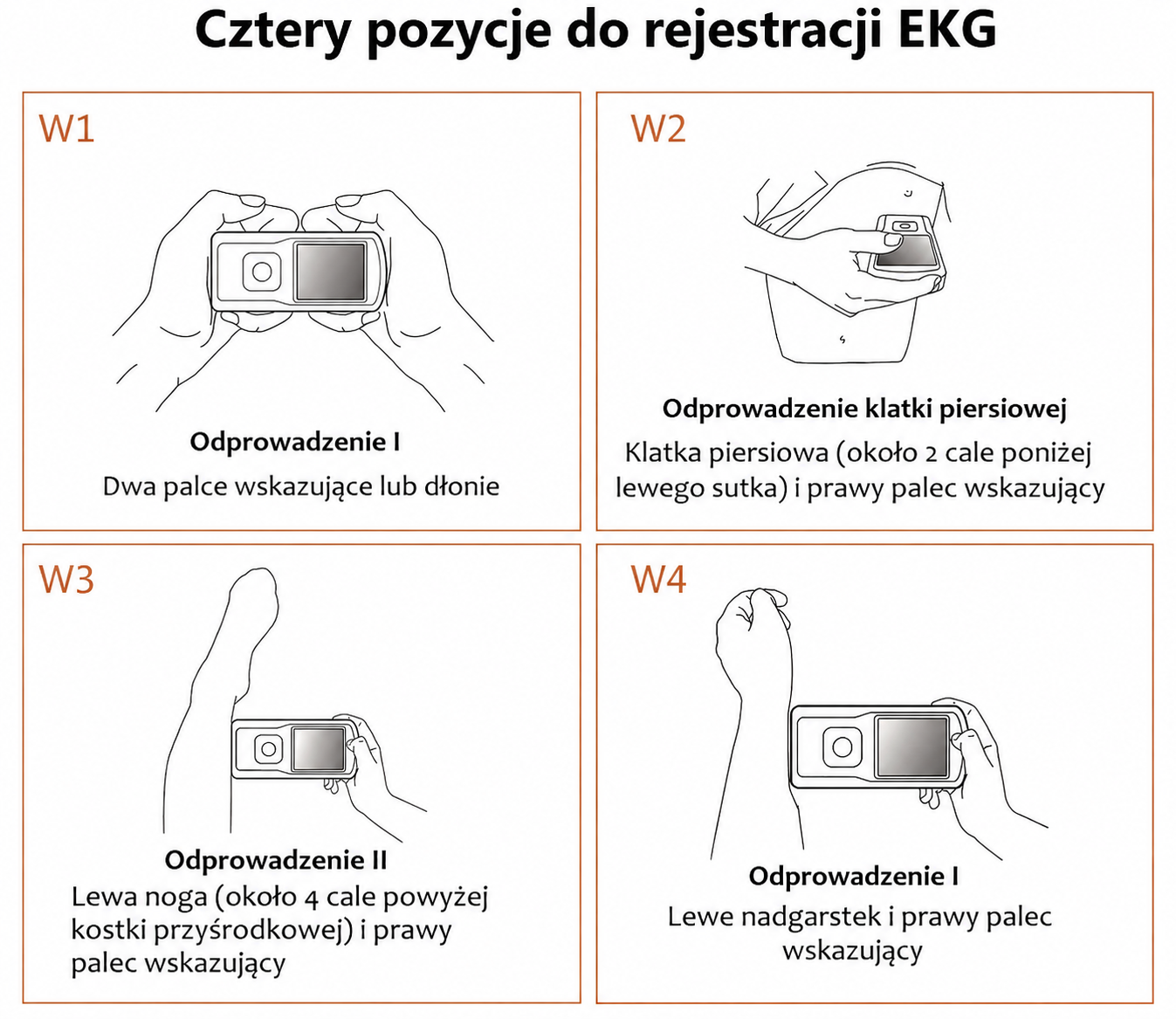 EMAY przenośny monitor EKG (kompatybilny z iPhone, Android, Mac i Windows) | Osobisty monitor serca EKG