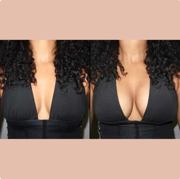 ULTRA LIFT STICKY BRA INSERTS