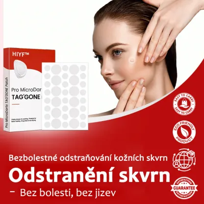 Náplasti na odstránenie kožných výrastkov KUBOZN® Pro MicroDarts TAG'Gone