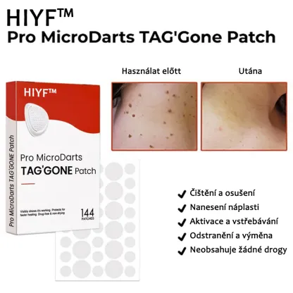 Náplasti na odstránenie kožných výrastkov KUBOZN® Pro MicroDarts TAG'Gone