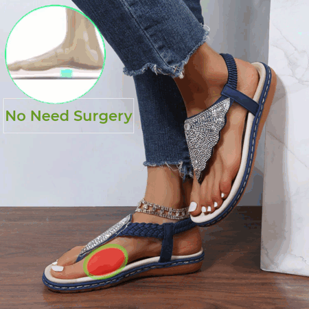 Women Casual Orthopedic Sandals, Crystal Rome Fashion Clip Toe Slippers