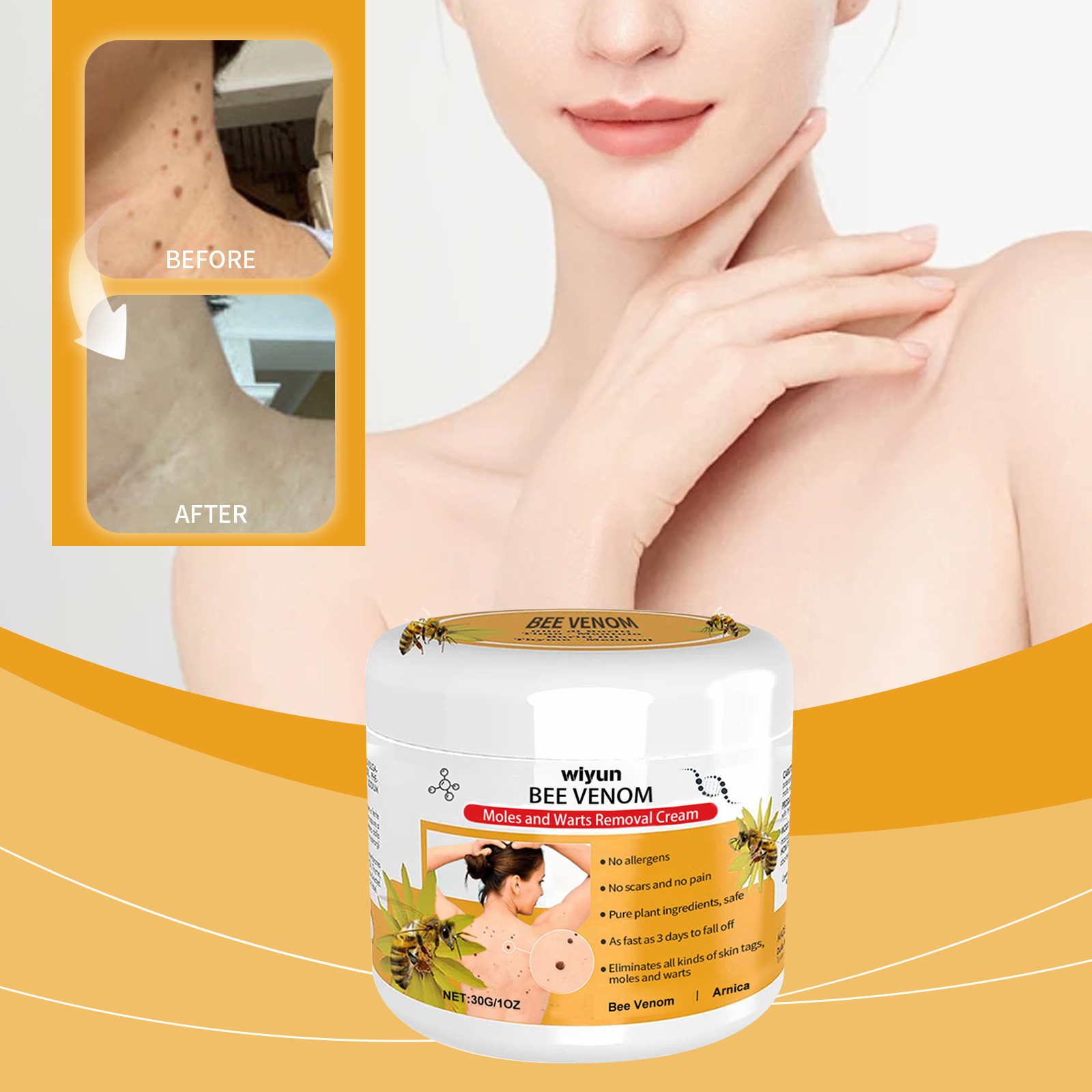 Bee Venom Mole and Wart Treatment Cream