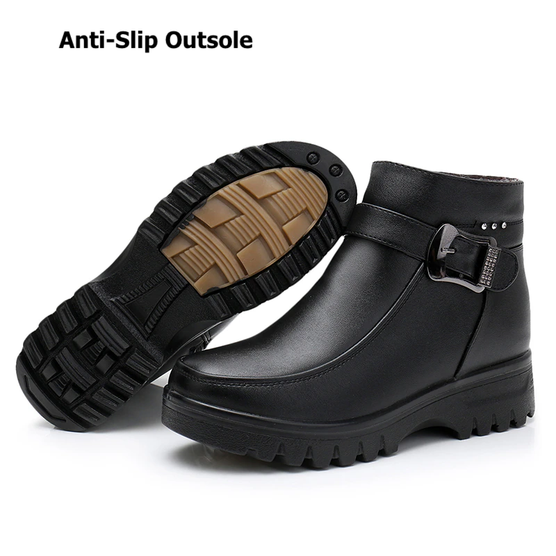 Orthopedic Women Ankle Boots Arch Support Warm Waterproof Genuine Leather Fashion