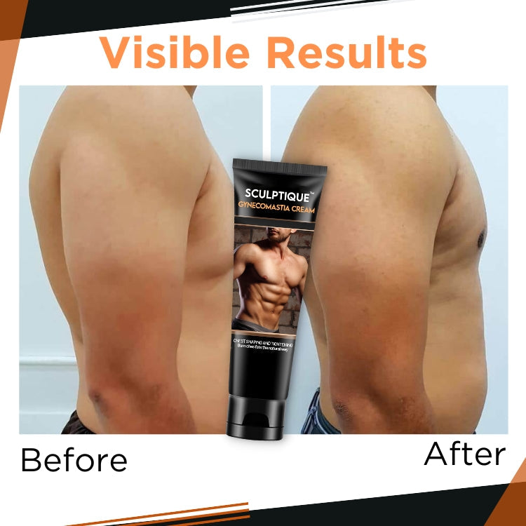 Gynecomastia Cream