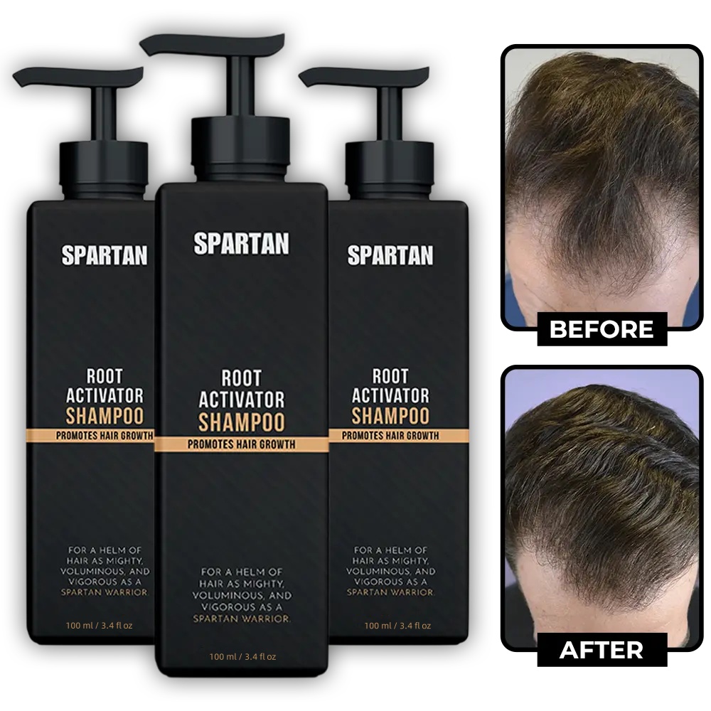 Spartan Root Activator Shampoo，Restoring Perfect Hair