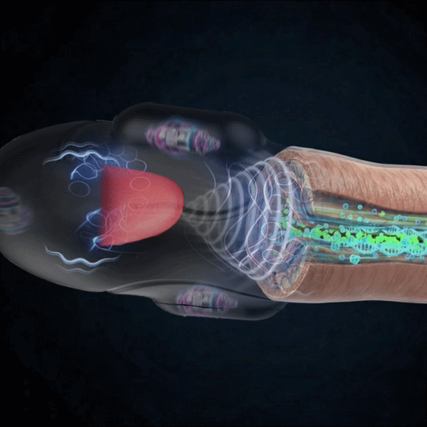 Stage 1 - Wave Therapy