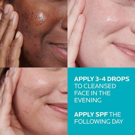 💧SALICYLIC ACID ACNE TREATMENT SERUM
