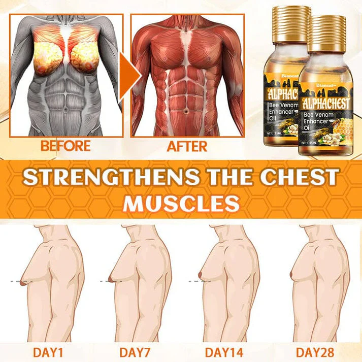 🔥MenTherm Bee Venom Gynecomastia Heating Oil