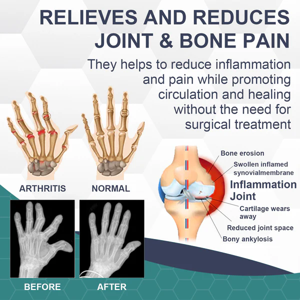 🐝 New Zealand Mānuka Bee Venom Bone & Joint Relief Cream