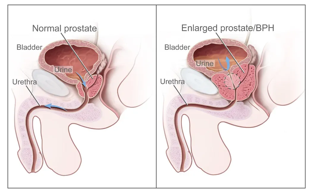 Inflammation and blood flow illustration
