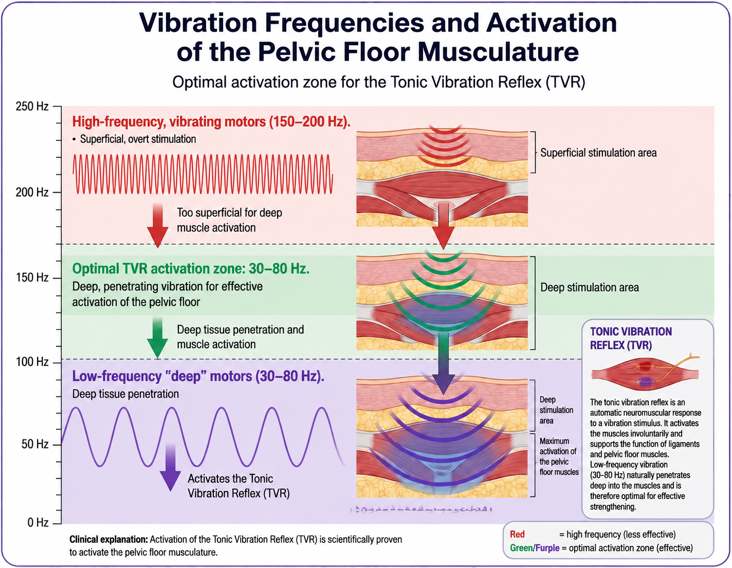 Optimal vibration frequency for pelvic floor