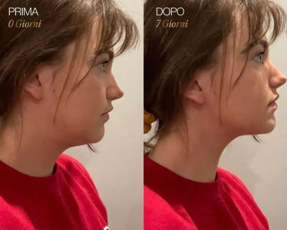 New Lymphatic Contour Face Brush Lymphatic Contour Facial Brush Scraping Eye And Neck Care Brush