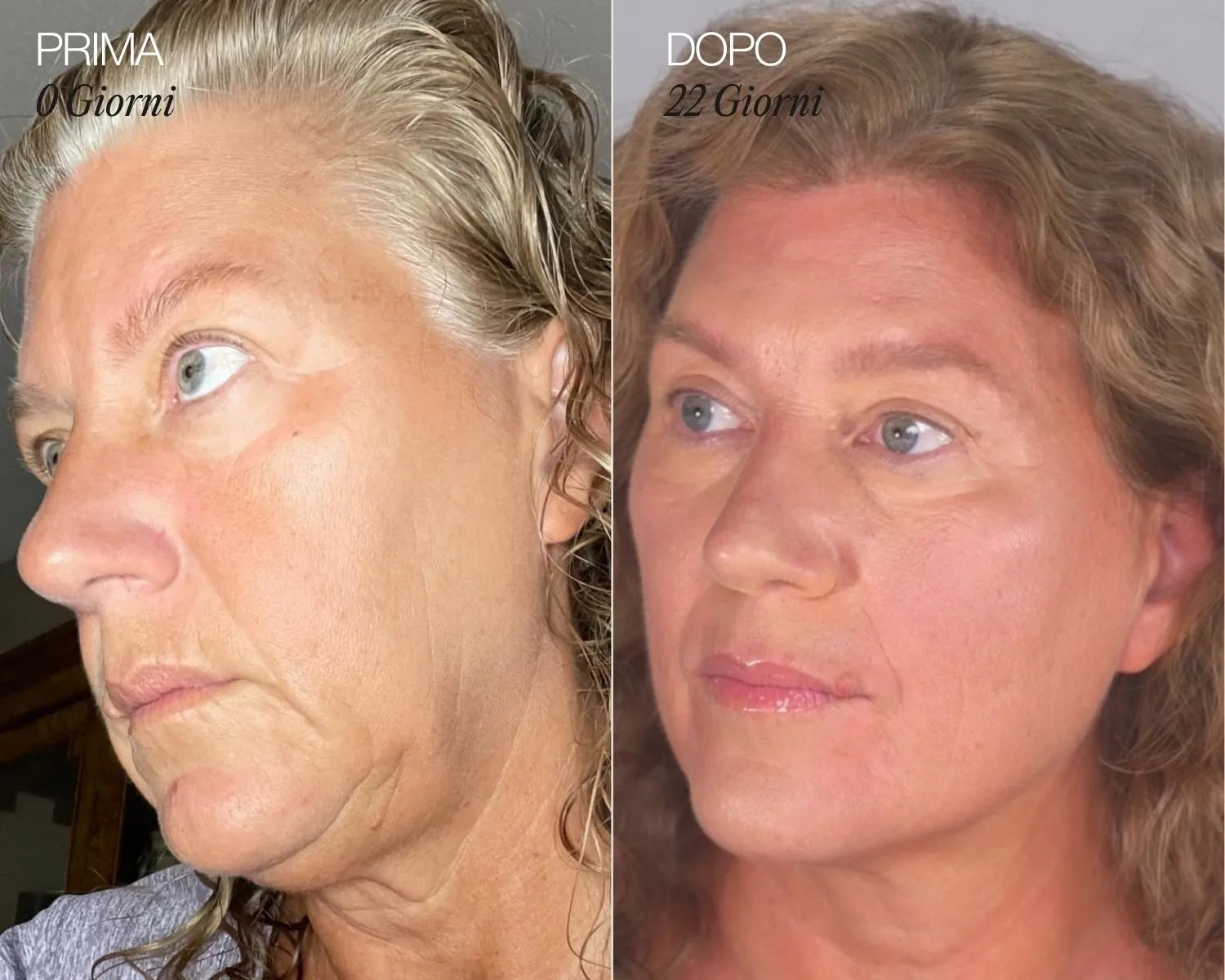 New Lymphatic Contour Face Brush Lymphatic Contour Facial Brush Scraping Eye And Neck Care Brush