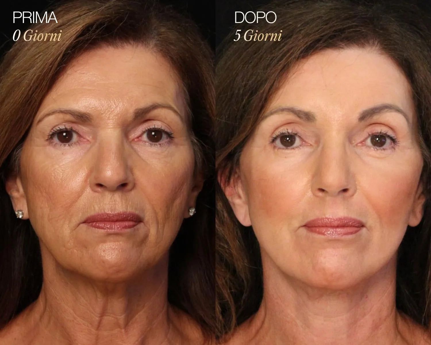 New Lymphatic Contour Face Brush Lymphatic Contour Facial Brush Scraping Eye And Neck Care Brush