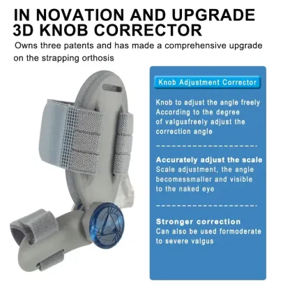 3D Knob Bunion Corrector Adjustable Toe Straightener with Detachable Magic Tape Strap for Hallux Valgus Correction