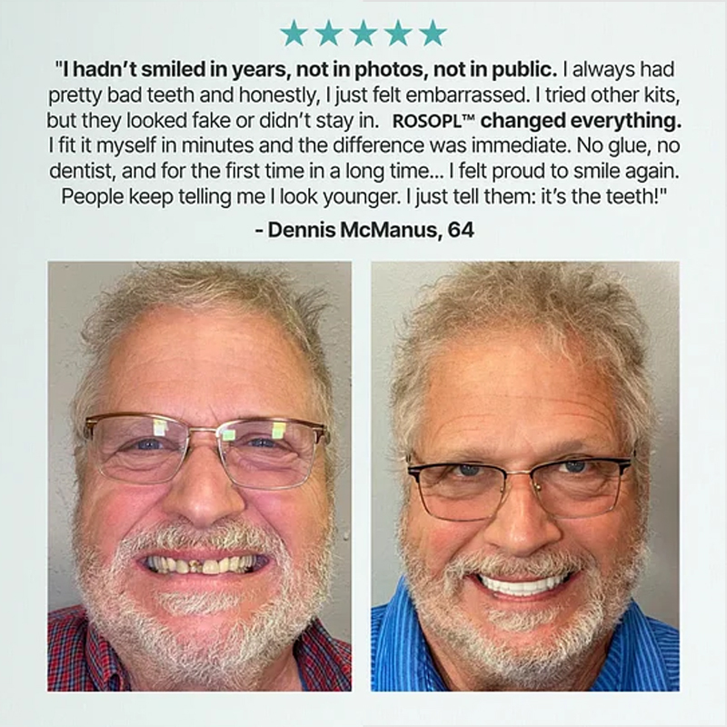 🔥Ends Today: 70% OFF! 🦷Custom-Fit Full Functional DenturesMake you more confident