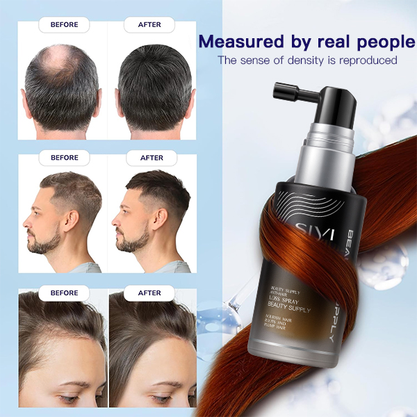 Scalp Care And Hair Growth Spray