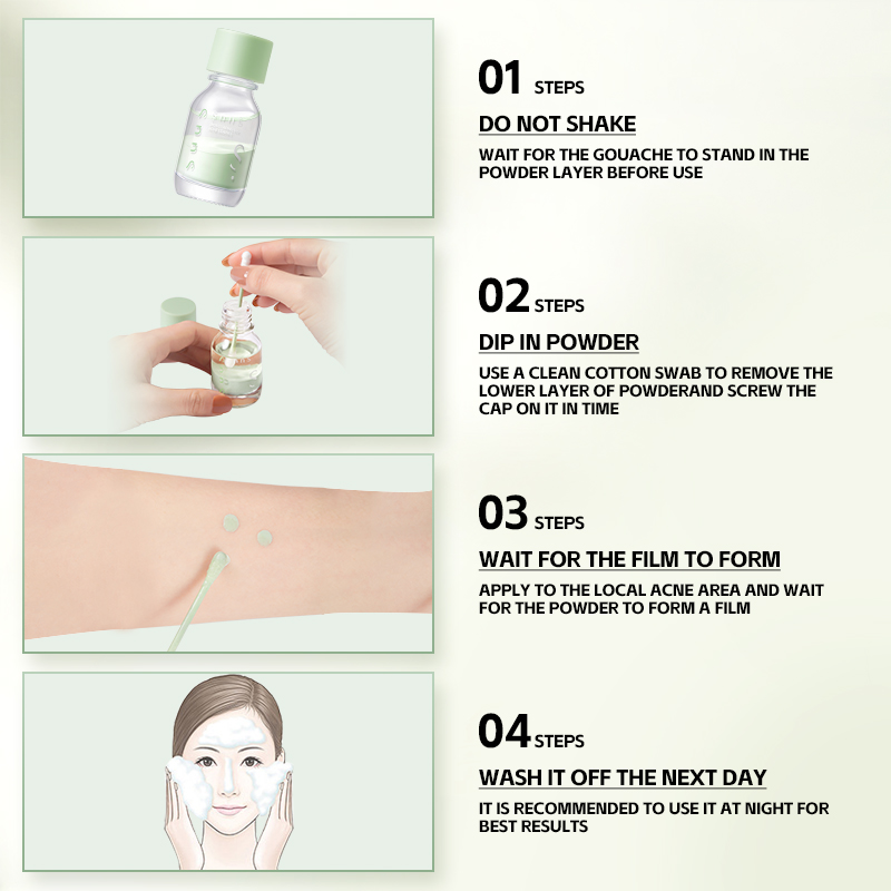 Acne Relief Serum