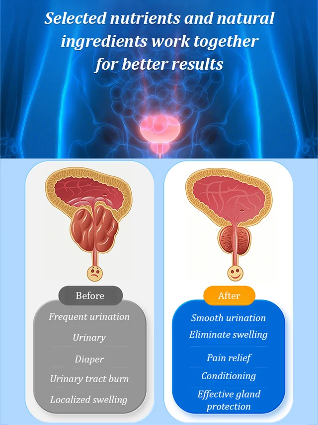 Lancetswell™ Saw Palmetto Prostate Health Supplement
