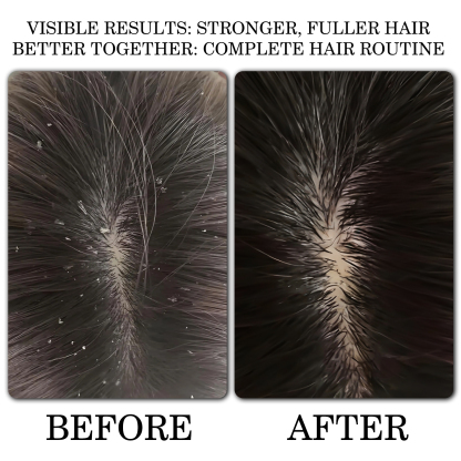 Moisturizing Conditioner + Anti-Dandruff Shampoo + Hair Treatment Oil