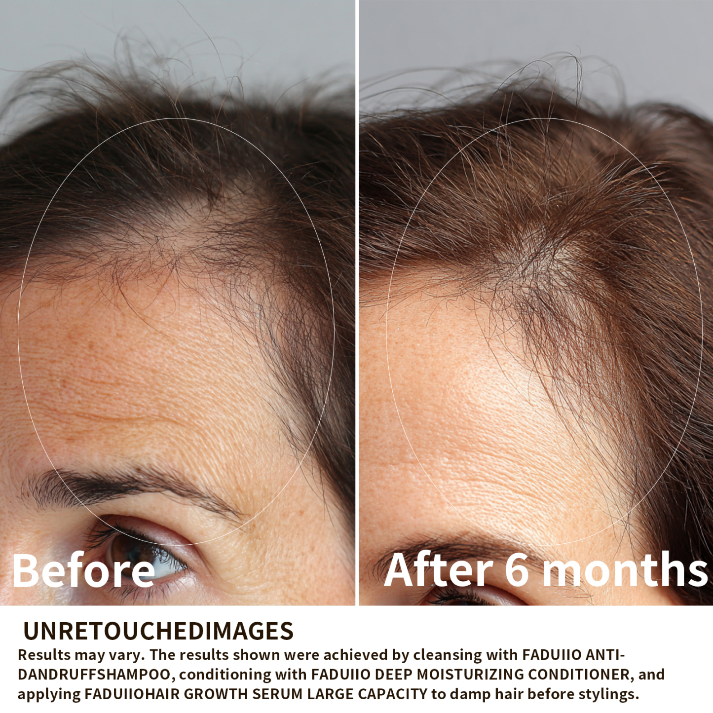 FADUIIO Hair Growth Serum with DAPO Biotin, Peptides, Caffeine & Ginseng – Daily Leave-In Treatment for Thinning Hair – Lightweight Formula for Visibly Thicker, Healthier-Looking Hair – 2 Fl Oz