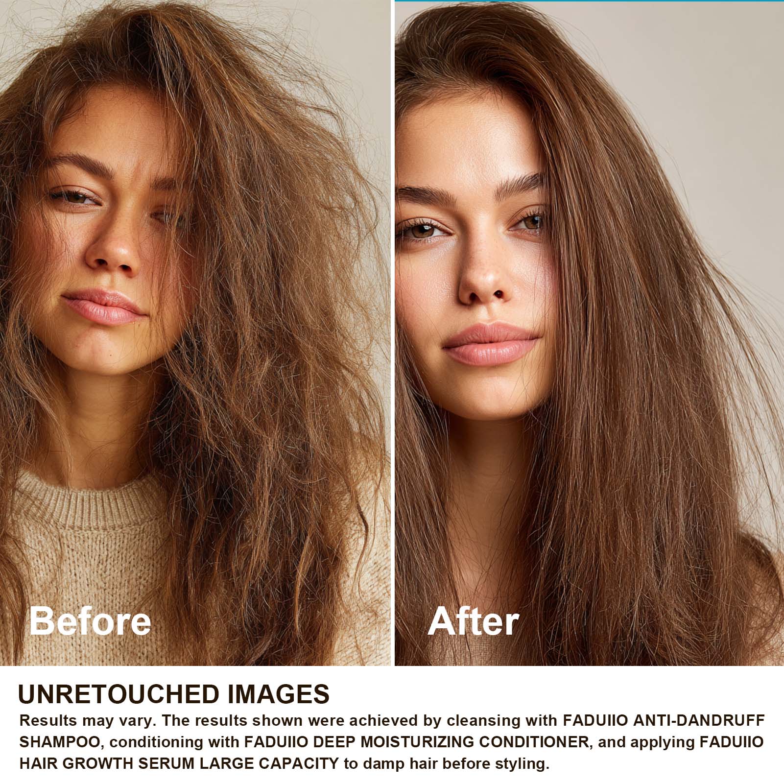 FADUIIO Anti-Dandruff Shampoo 2-Pack – Flake Control, Itchy Scalp Relief, Natural Extracts, Sulfate-Free, 200ml Each