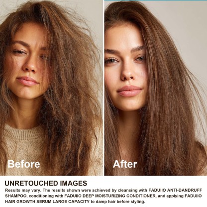 FADUIIO Anti-Dandruff Shampoo 2-Pack – Flake Control, Itchy Scalp Relief, Natural Extracts, Sulfate-Free, 200ml Each