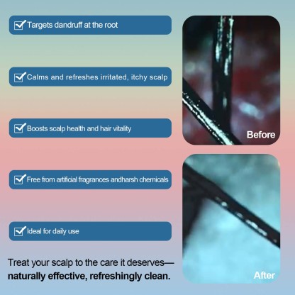 FADUIIO Anti-Dandruff Shampoo 2-Pack – Flake Control, Itchy Scalp Relief, Natural Extracts, Sulfate-Free, 200ml Each