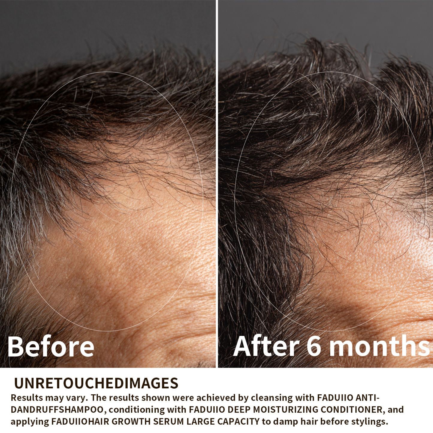 FADUIIO Hair Growth Serum with DAPO Biotin, Peptides, Caffeine & Ginseng – Daily Leave-In Treatment for Thinning Hair – Lightweight Formula for Visibly Thicker, Healthier-Looking Hair – 2 Fl Oz